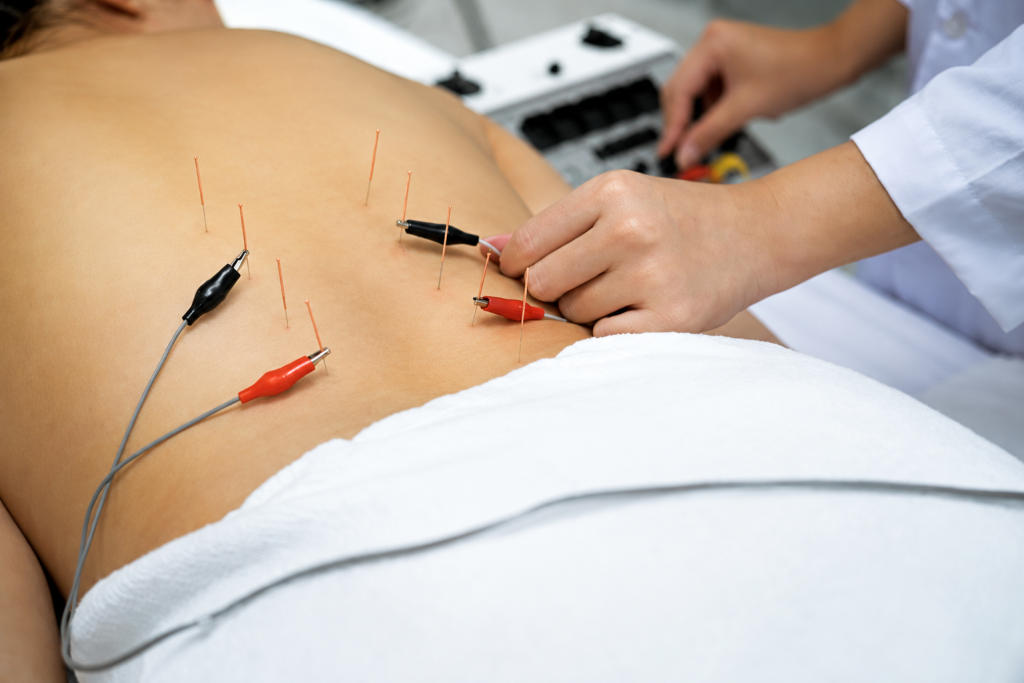 tratamiendo de electropuncion para el dolor de espalda en son vida